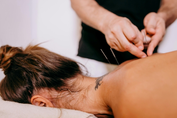 Acupunture chez Novaction