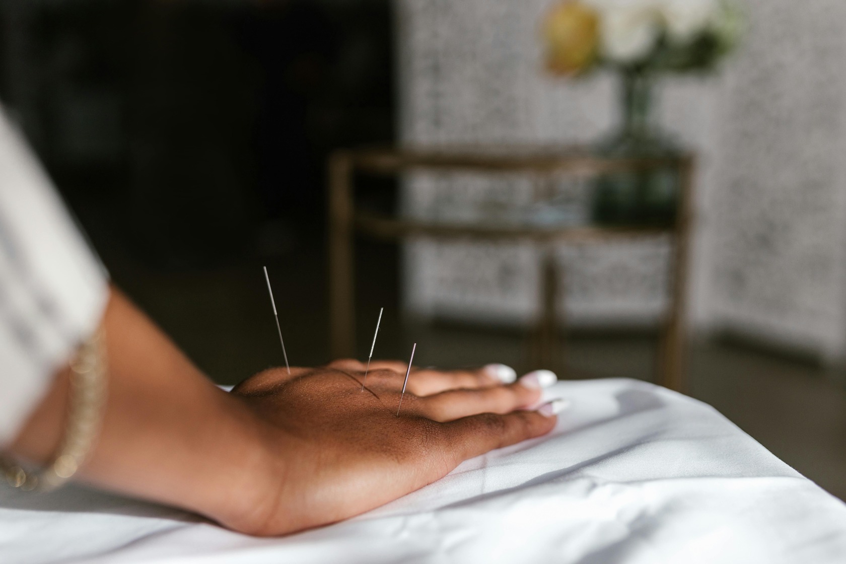 Acupunture chez Novaction